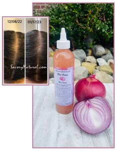 Our specially formulated Red Onion Hair Tonic is infused with a blend of powerful and essential ingredients, including red onion, MSM, Vitamin E, rice oil, and glycerin, that work extremly well together to promote healthy hair growth, stimulate regrowth and repair follicles, reduce hair fall and also improve hair elasticity.  The high levels of sulfur, vitamins, and minerals in our unique formulation provide the necessary nourishment to the hair and scalp, promoting new growth and thickness, whi Msm Vitamin, Regrow Thinning Hair, Onion Hair, Natural Shampoo And Conditioner, Onion For Hair, Breaking Hair, Reduce Hair Fall, Stimulate Hair Follicles, Promote Healthy Hair Growth