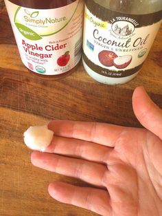 Warts are annoying, but common! Here's how you can use apple cider vinegar for warts to effectively get rid of them for good. Planter Warts Remedies, Natural Wart Remover, Planters Wart, Natural Wart Remedies, Warts On Hands, Warts On Face