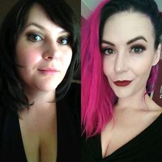 136lbs weight loss with PCOS and Endometriosis