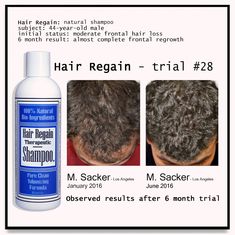 HAIR REGAIN REGROWTH SHAMPOO -real eBay reviews from our hair growth buyers-                          Hair Regain Shampoo is great!                               Buyer: 22cake (32)                      Feb-11-21   271751702751                 Great product. Thank you for selling it!                          Buyer: sumannet (577)                 Feb-10-21   271408307633                  Seeing growth! Will order more                                  Buyer: sbhaf2 (85)                       Feb-04 Hair Regrowth Remedies, Thicker Stronger Hair, Hair Regrowth Shampoo, Natural Hair Regrowth, Shampoo Ingredients, Types Of Hair, Regrow Hair, Hair Control, Natural Shampoo