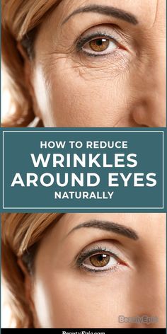 Wrinkles generally reduce the self-confidence of an individual. If you are one of the victims of eye wrinkles then you can smile since this article gives.#wrinkle #wrinkleremover #wrinklesremediesface #wrinkles #wrinklesaroundmouth #wrinklearoundmouth #wrinkletreatment #howtogetridofrinkles #HOWTOREMOVEWRIKLE #wrinklecream #USA #UNITEDSTATES #UNITEDKINGDOM #CANADA Make Up Diy, Moisturizer For Oily Skin, Eye Wrinkle