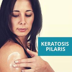 Keratosis Pilaris Remedy, Skin Education, Medical Esthetics, Master Esthetician, Skin Studio, Red Rash, Professional Skincare, Bumpy Skin