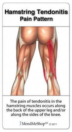 an image of the back of a man's legs with tendonts highlighted