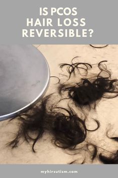 Is Hair Loss from PCOS Reversible? Dark Green Vegetables, Autumn Hair, Hair Growth Cycle, New Hair Growth, Nourishing Shampoo, Body Hair Removal, Hair Regrowth, Healthy Hair Growth, Roots Hair