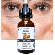 CAFFEINE 30% INFUSION & GREEN TEA Bags Under Eyes Reducer Organic Serum Bottle Dropper 1 fl oz (30 ml) CAFFEINE BENEFITS: Caffeine is soothing and can reduce under-eye bags. Caffeine is an antioxidant and can help protect against damage and keep your eye area looking its best. PRODUCT MADE IN USA Caffeine premium organic coffee concentrate (30%), cosmetic grade, green tea beans, liquid silica & vegan glycerin. (KEEP IT REFRIGERATED AFTER OPENED). Our products are made with the best quality ingre Coffee Under Eye Mask, Under Eye Bags Remedies, Eye Bags Remedy, Caffeine Benefits, Skin Tightening Essential Oil, Facial Scrub Recipe, Face Wrinkles Remedies, Eye Bags Makeup, Puffy Eyes Remedy