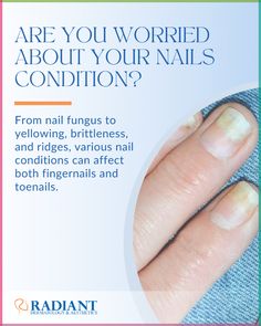 From nail fungus to yellowing, brittleness, and ridges, various nail conditions can affect both fingernails and toenails. 💅 Don't let these concerns go unnoticed! Consult the experts at Radiant Dermatology & Aesthetics for a proper diagnosis and personalized treatment plan. 💪💅 Achieve healthier and more beautiful nails by scheduling an appointment with us today! 💅✨ 📞 281-973-4159 📧 info@radiantdermtx.com 🌐 radiantDermTX.com Nail Conditions, Types Of Cancers, Nail Fungus, Hair Restoration, Dermatology, Skin Conditions, Toe Nails, Beautiful Nails