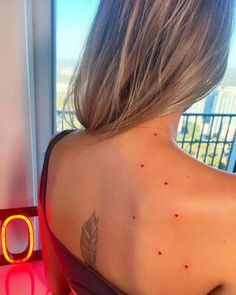 the back of a woman's shoulder with red spots on her left upper arm