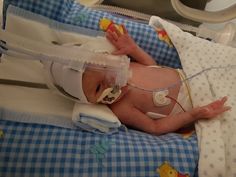 a baby in a hospital bed wearing an oxygen mask