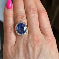 a close up of a person's hand with a blue ring on their finger