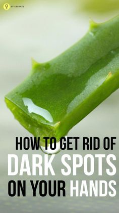 How To Get Rid Of Age Spots On Hands, Dark Spots On Hands How To Remove, Black Spots On Legs Remove, Dark Spots On Legs Remove Diy, Diy Dark Spot Remover, Dark Spots On Hands, Skin Cleanser Diy, Dark Spots On Legs, Brown Spots On Hands