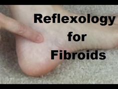 (54) Reflexology for Fibroids - Massage Monday #274 - YouTube Reflexology Points, Fibroid Tumors, Reflexology Massage, Massage Benefits, Healing Therapy, Physical Pain, Good Mental Health