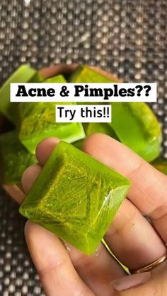 Natural Skin Care Ingredients, Pimples Remedies, Clear Healthy Skin, Natural Skin Care Remedies, Diy Skin Care Routine, Natural Face Skin Care, Good Skin Tips, Diy Skin Care Recipes, Face Pack