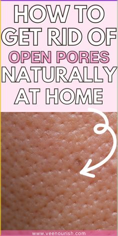 How To Minimize Pores Naturally, Facial Pores Remedies, Shrink Pores On Face Diy, Clean Pores On Face Diy, How To Tighten Pores On Face, Decrease Pores On Face, No Pores Skincare, Homemade Pore Cleaner, How To Get Rid Of Large Pores