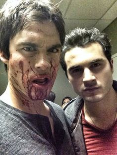 two young men with blood all over their face and neck, posing for the camera