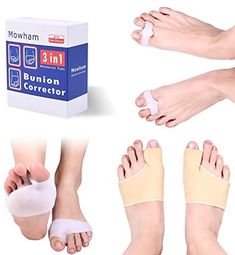 Amazon.com: Orthopedic Bunion Corrector & Bunion Relief 6pcs Big Toe Separators Set - Pain Relief in Hallux Valgus,Non-Slip Protector Sleeves | Hammer Toe Straighteners | Bunion Pads | Aid Treatment: Health & Personal Care Onion Oil For Hair, Glitter Hair Spray, Toe Spacers, Toe Straightener, Gel Toes, Luscious Hair, Health Facts, Day Night, العناية بالشعر