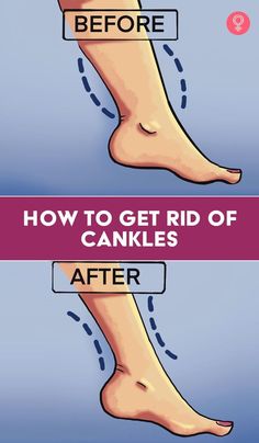 how to get rid of candles before and after it is removed from the feet with an ad