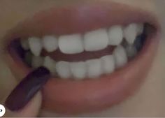 Teeth Aesthetic, Pretty Teeth, Perfect Teeth, Vampire Teeth, Vision Board Manifestation, Beauty Goals, White Teeth, Dream Body, Aloe Vera Gel