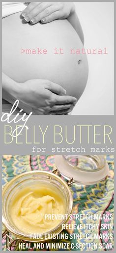 Body Butter For Pregnant Women, Homemade Stretch Mark Cream, Diy Stretch Mark Oil, Stretch Mark Prevention, Stretch Mark Oil, Relieve Itchy Skin