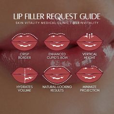 Lock in your best lips with Skin Vitality's Lip Filler Request Guide ��👄 Unsure what to ask for at your lip filler consultation? Choose your favourite features from our guide✨   Call (877) 346-6926 to book your appointment with a regulated Healthcare Professional 👨‍⚕️⚕️ Helping the most people look and feel beautiful in Canada since 1992 🖤 Pillow Lips Filler, Full Syringe Lip Filler Before And After, Julie Horne Lip Filler, Bratz Lip Filler, Lip Filler Injection Techniques, Diy Lip Filler, Asian Lip Filler, Lip Filler Swelling Day By Day, Lip Shapes Filler