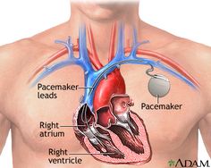 a diagram of the human heart with labels on each side and an arrow pointing to the right