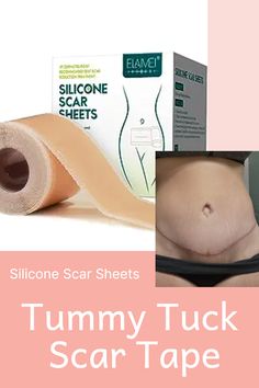 Silicone Scar Sheets works to diminish the appearance of hypertrophic scars and keloids, which have a raised and/or discolored appearance. Pain-Free Scar Reduction - Our Silicone Scar Tape is made with hospital medical-grade soft silicone. Mastectomy Reconstruction, Hypertrophic Scars, Scar Reduction, Scar Removal, C Section, Tummy Tucks, Pain Free, Soft Silicone