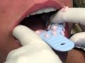 Dental Impressions are easier than you think Health Care Tips, Dental Office Decor, Night Hairstyles, Dental School, Philips Sonicare, Oral Health Care, Dental Hygienist