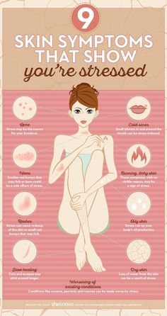 Skin Symptoms, Healing Dry Skin, Time To Relax, Cold Sore, Image Skincare, Itchy Skin, Skin Health, Apple Cider