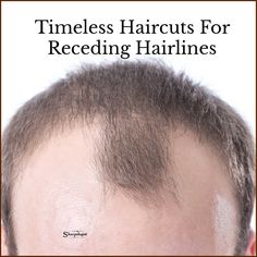 Short Hair Men Receding Hairline, Men Haircuts With Beards, Men Very Short Haircut, Mens Hairstyles Receding Hairline Thinning Hair Men Haircuts, Buzz Cut For Receding Hairline, Classic Male Haircut, Men’s Haircuts For Receding Hairline, Best Haircut For Receding Hairline Men, Hair Cuts For Receding Hairline Men