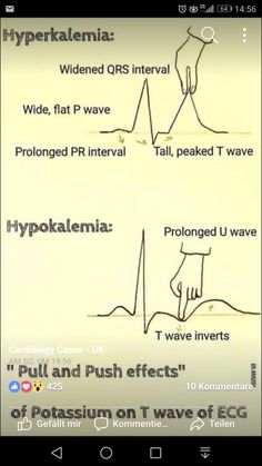 a cell phone screen showing different types of waves and their corresponding words on the screen