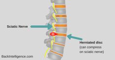 an image of a diagram of the back of a neck and its location in which it is located