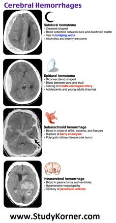 an mri scan shows the different areas of the brain and how they are related to it