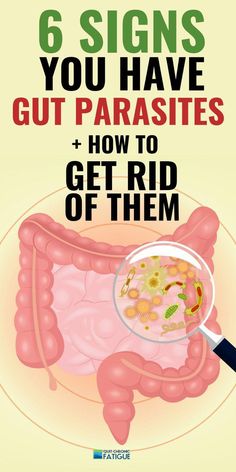 Are Stomach Parasites Causing Your Fatigue? You might wonder why I'm including an article on stomach parasites symptoms in a website about chronic fatigue Parasites Symptoms, Intestinal Parasites, Parasite Cleanse, Stomach Problems, Home Health Remedies, Colon Cleanse, Natural Health Remedies, Chronic Fatigue