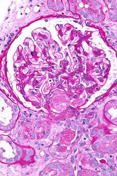 Clotting Cascade, Psych Np, Disseminated Intravascular Coagulation, Medication Adherence, Lab Science, Cold Spring Harbor, Lung Transplant, Medical Lab