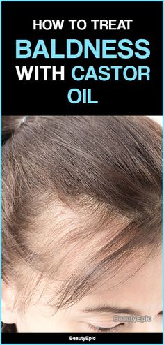 Thinning Hair Remedies, Castor Oil For Hair Growth, Oil For Hair Growth, Skincare Natural, Castor Oil For Hair, Hair Growth Shampoo, Vitamins For Hair Growth, Oil For Hair, Home Remedies For Hair