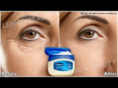 Vaseline For Face, Face Wrinkles Remedies, Wrinkles Remedies Face, Get Rid Of Wrinkles, Wrinkle Remedies, Face Makeup Tips, Skin Care Wrinkles, Beauty Tips For Glowing Skin, Natural Aging