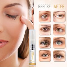 Eye Bags Makeup, Remove Eye Bags, Instant Face Lift, Under Eye Wrinkles, Anti Aging Eye Cream, Dark Circles Under Eyes, Reduce Dark Circles, Face Wrinkles, Delicious Snacks