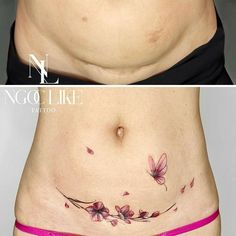 before and after photos of a woman's stomach with flowers on her tummy