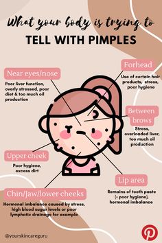 Pimples Reasons Faces, Pimple Face Guide, Why You Get Acne In Certain Areas, Causes Of Pimples On Face, Placement Of Pimples Meaning, What Pimples In Different Places Means, Reasons Of Pimples On Face, What Ur Acne Mean, Reasons For Pimples On Face