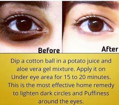 Exposed Skin Care, Clear Healthy Skin, Natural Skin Care Remedies, Good Skin Tips, Skin Care Face Mask, Beauty Tips For Glowing Skin, Perfect Skin Care Routine, Homemade Beauty Tips