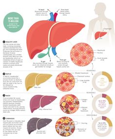 Fighting the fatty liver - Nature