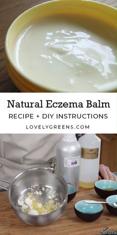 Skincare recipe for making neem balm for eczema & psoriasis. It's all-natural and the ingredients soothe inflammation, itchiness, & flakiness Message Oil, Dry Cough Remedies, Balm Recipe, Salve Recipes, Baking Soda Shampoo, Full Disclosure, Natural Cough Remedies, Cough Remedies, Neem Oil