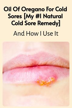 Save this pin to learn how I use oil of oregano for cold sores. If you’re looking for a natural cold sore remedy that packs a punch, this might become one of your favorites, too.