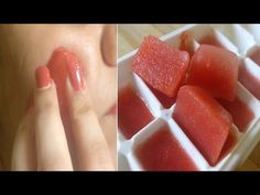 Tomato Lemon Ice cubes for Skin whitening, Pimples,dark spots, blemish, suntan, Acne - YouTube Tomato For Skin, Lemon Ice Cubes, Lemon On Face, Lemon Ice, Whitening Face, Homemade Recipe, Toenail Fungus, Skin Cleanser Products, Beauty Recipe