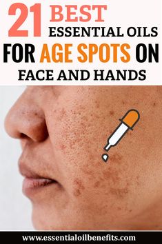 Age Spots Essential Oils, Essential Oils For Age Spots, Age Spots On Face, Makeup Tip, Beach Blonde