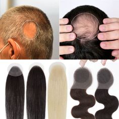 ad eBay - US Cover-up Tape Human Hair Patch Bald Spot Hairpiece Toupee For Alopecia Areata - Buy Now, click the link (eBay) Alopecia Hairstyles, Bald Spot, Hair Due, Styling Products, Wigs Hair Extensions, Hd Lace, Hair Piece, Hair Pieces, Hair Lengths