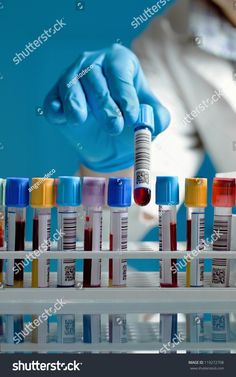 a person in blue gloves is doing something with colored liquids on the table and behind them are test tubes filled with blood