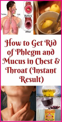 How To Get Rid Of Phlegm And Mucus In Chest & Throat (Instant Result) Mucus In Chest, Phlegm In Throat, Mucus In Throat, Getting Rid Of Mucus, Getting Rid Of Phlegm, Throat Remedies, Asthma Remedies, Lung Health, Healthy Lungs