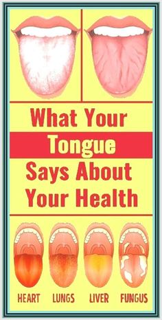 What Your Tongue is Trying to Tell You About Your Health Yoga Information, What Is Health, Health Plus, Tea Health Benefits, Coconut Health Benefits, Tongue Health, Healthy Goals, Healthy Advice, Health Tips For Women