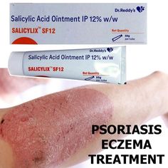 Visit Our Store Store Link :- Indiasellerdeal Check Out Our New Listed Product Click Here :- NEW PRODUCTS 2 X Salicylic Acid SF 12 Ointment 50gm for Psoriasis Eczema Skin Treatment Salicylix SF 12 percent cream contains 12 percent Designed to control the development of free radicals in the eyes salicylic acid. Salicylic acid is a keratolytic medication that aids the removal of the external layer of the skin and increases skin hydration. It also acts as an antiseptic by virtue of its action again Treating Dandruff, How To Treat Dandruff, Face Mapping Acne, Reducing Inflammation, Natural Acne Remedies, Treat Acne, Skin Hydration, Face Acne, Acne Blemishes