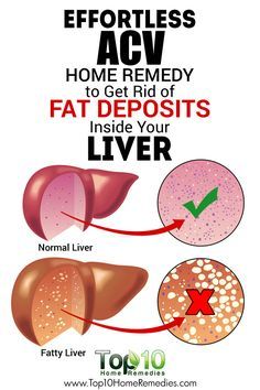 Top 10 Home Remedies, Detox Your Liver, Liver Diet, Cholesterol Remedies, Overnight Oat, Holistic Remedies, Liver Detox, Healthy Liver, Natural Therapy